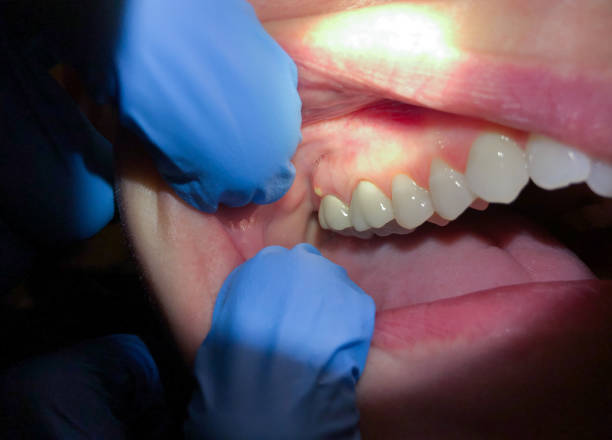Best Emergency Cosmetic Dentistry in De Smet, SD